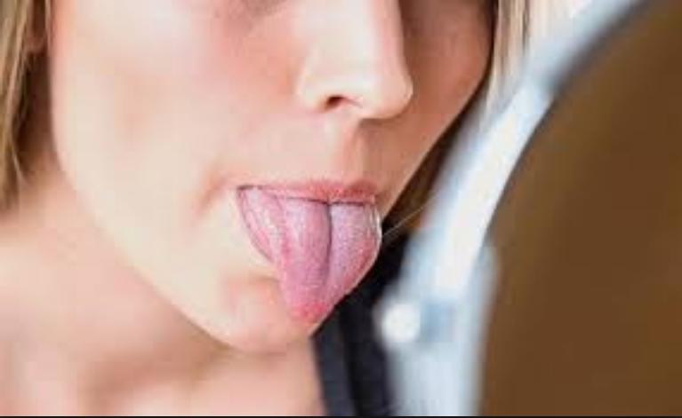 Човешки език симптоми