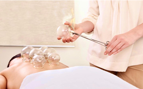 Акупунктура