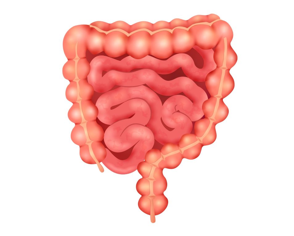 Правилна диета при раздразнено дебело черво